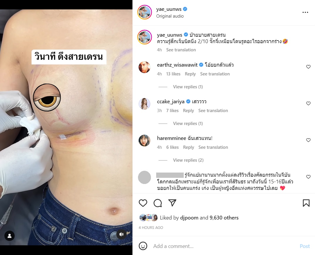 หญิงแย้ นนทพร
